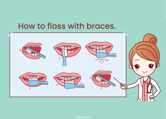how-to-floss-with-braces